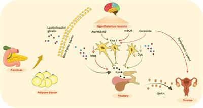 Childhood obesity and central precocious puberty